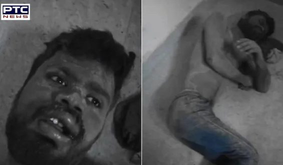 Agra man claims he was buried alive by four men and rescued by stray dogs who dug him up